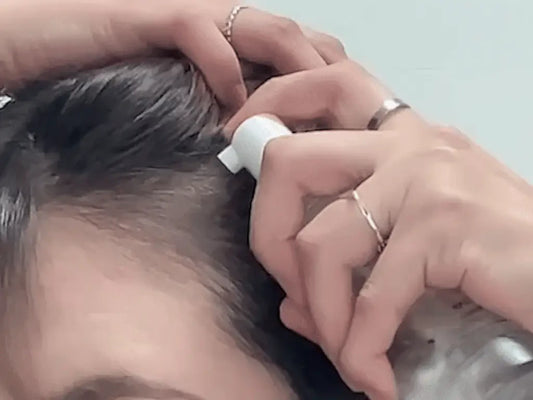 ROOTONIX Rosemary Biotin Scalp Tonic Korean Hair Care