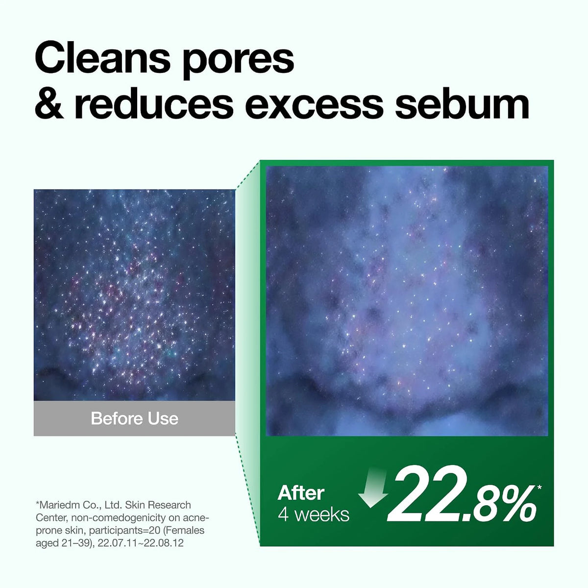Pore and sebum before-and-after infographic with a four-week reduction claim for ANUA cleansing care.