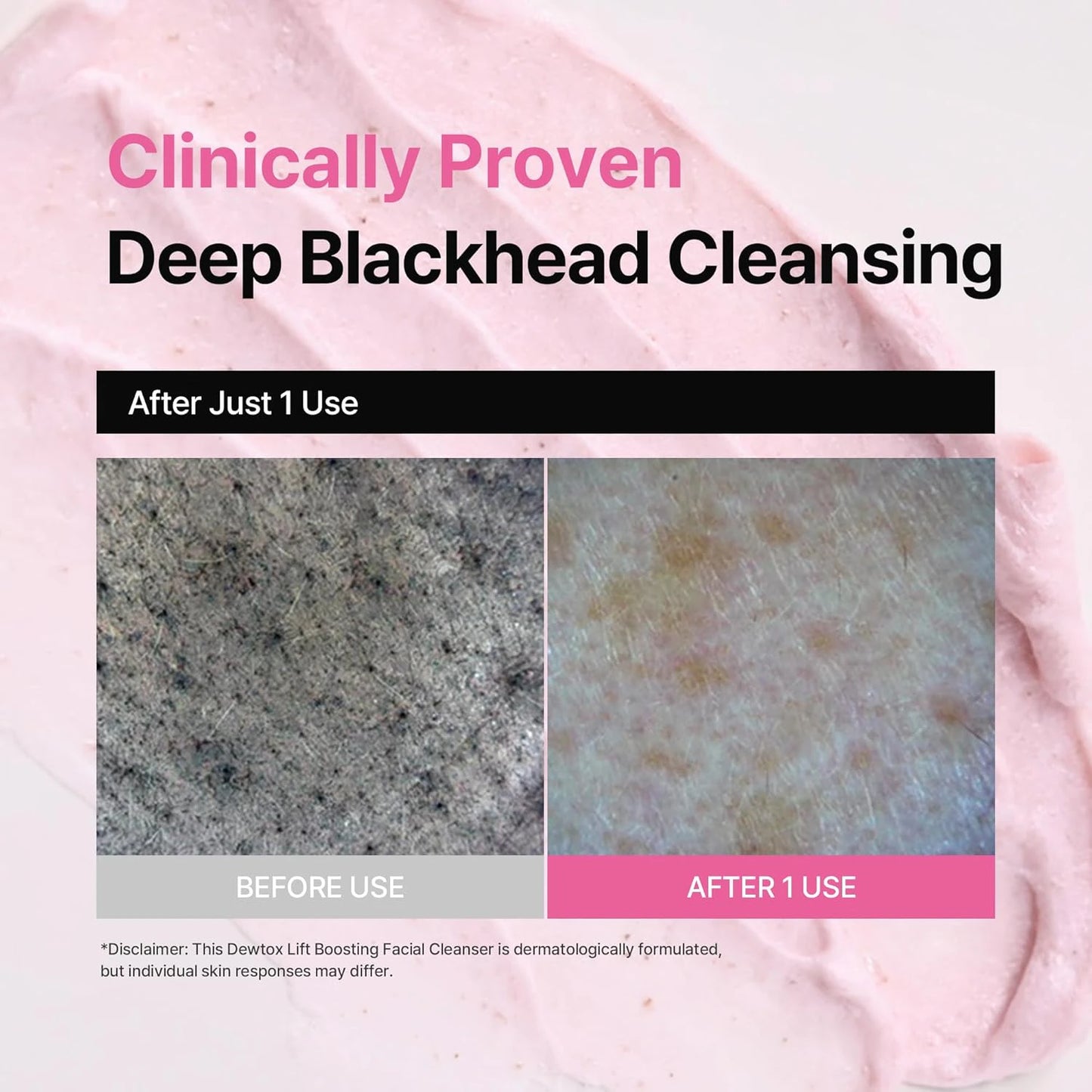dewdap Dewtox Lift Boosting Pack Cleanser Korean Cleansers