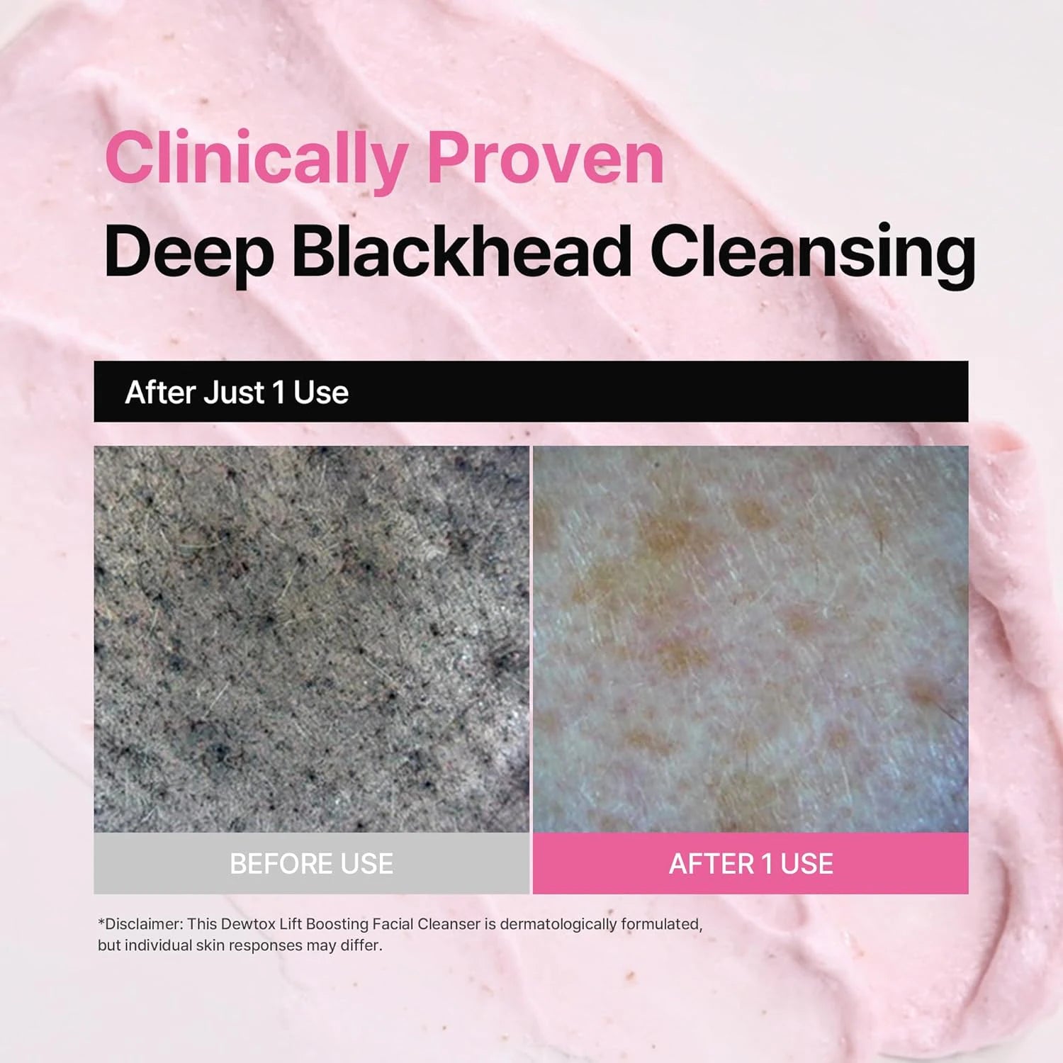 dewdap Dewtox Lift Boosting Pack Cleanser Korean Cleansers