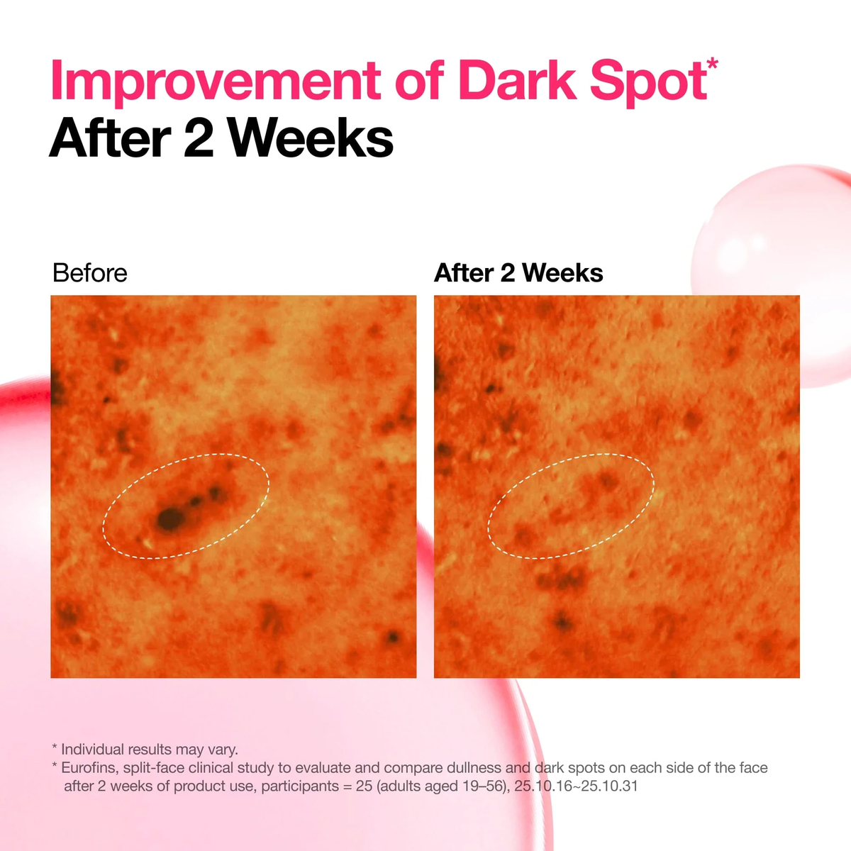 ANUA toner study panel with before-and-after close-ups showing reported dark-spot improvement after two weeks.