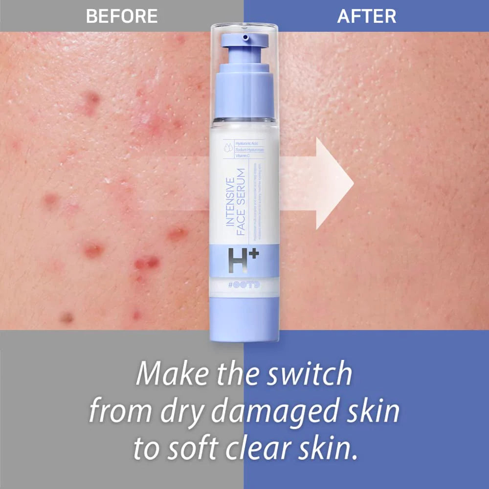 #OOTD Intensive Moisture Face Serum A.M. Korean Moisturizers