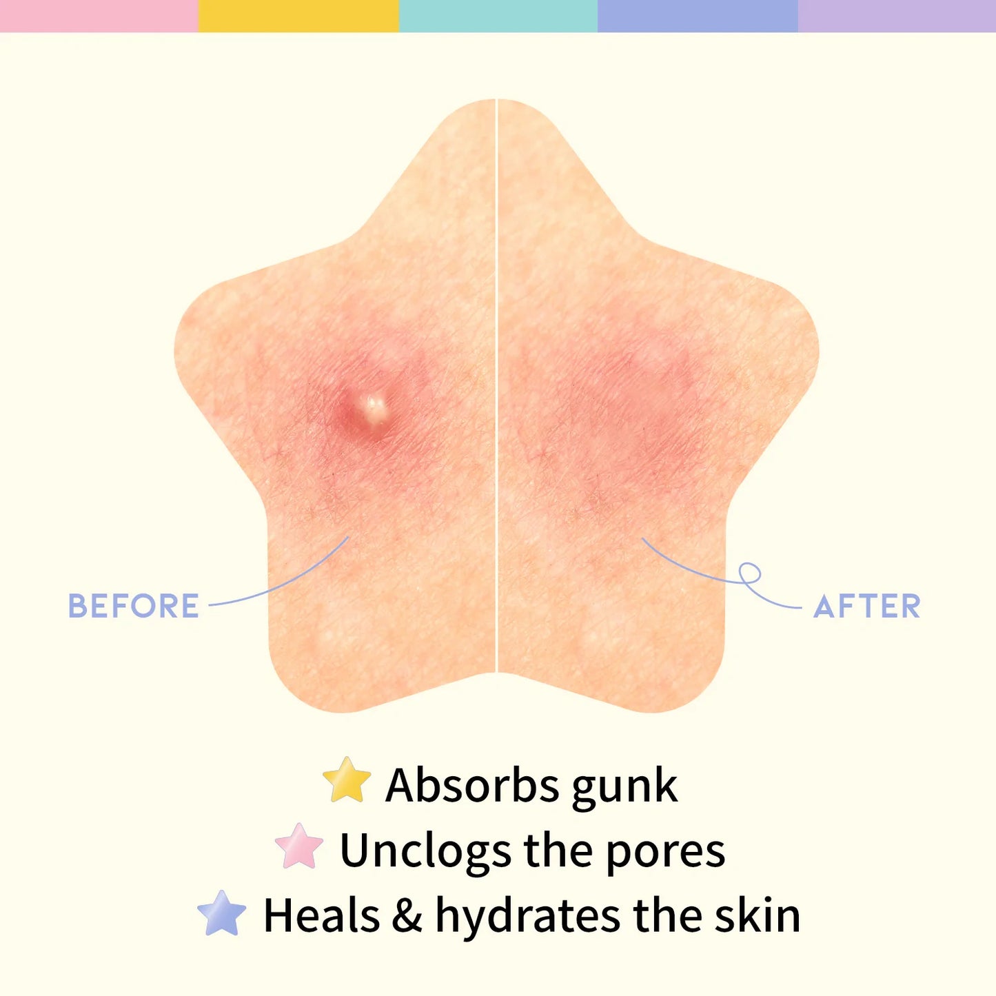#OOTD Star Spot Patch (80 Dots) Korean Spot Treatments