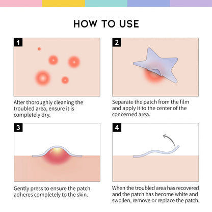 #OOTD Star Spot Patch (80 Dots) Korean Spot Treatments