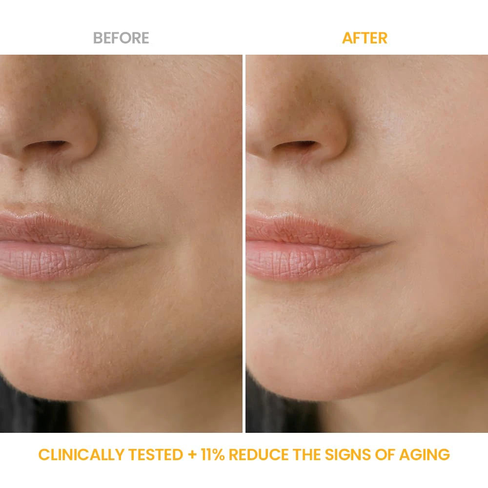 #OOTD Snail Mucin Lifting Cream product use graphic with cheek application panels.