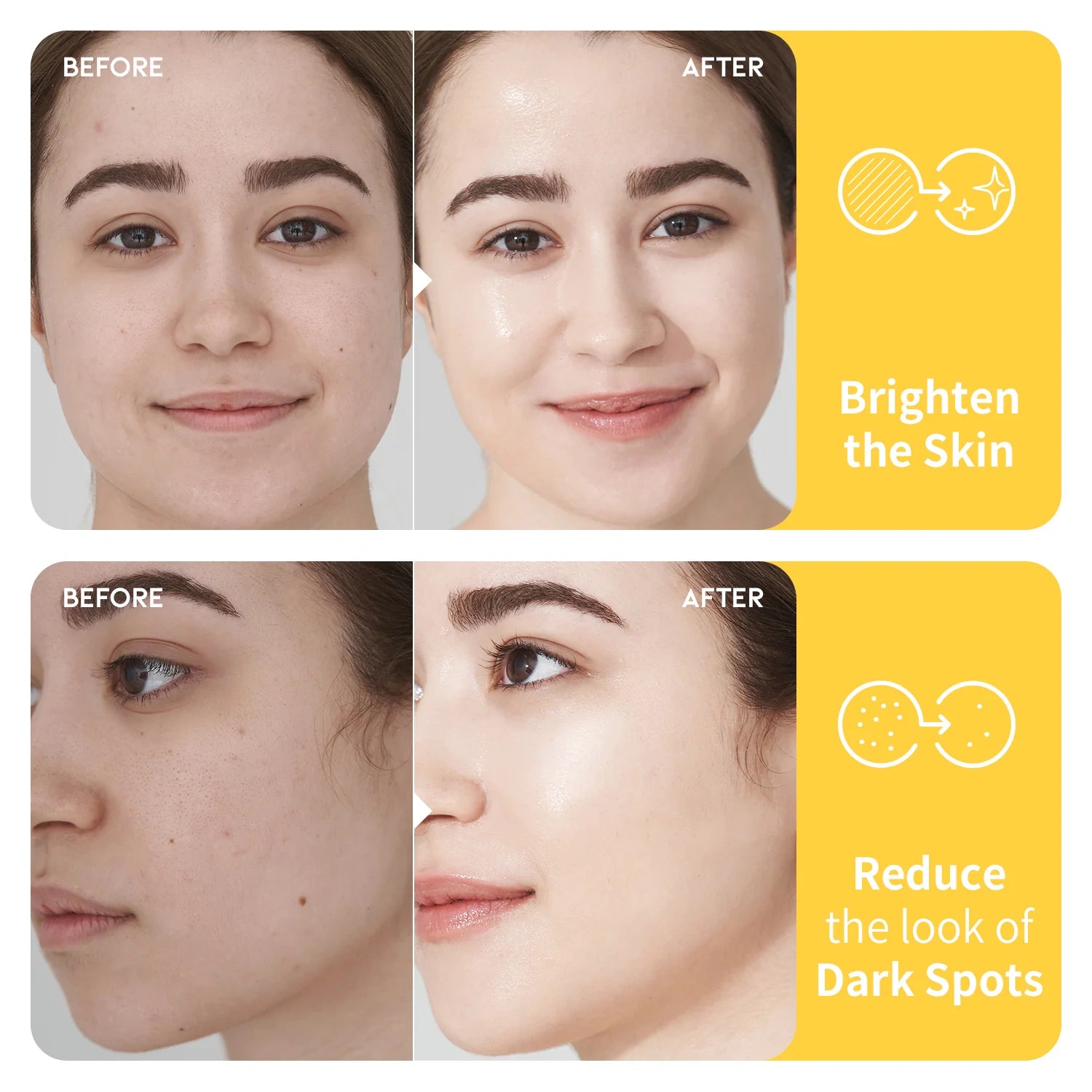 #OOTD Dark Spot Vitamin C Toner Korean Toners