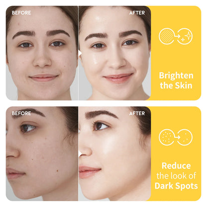 #OOTD Dark Spot Vitamin C Toner Korean Toners