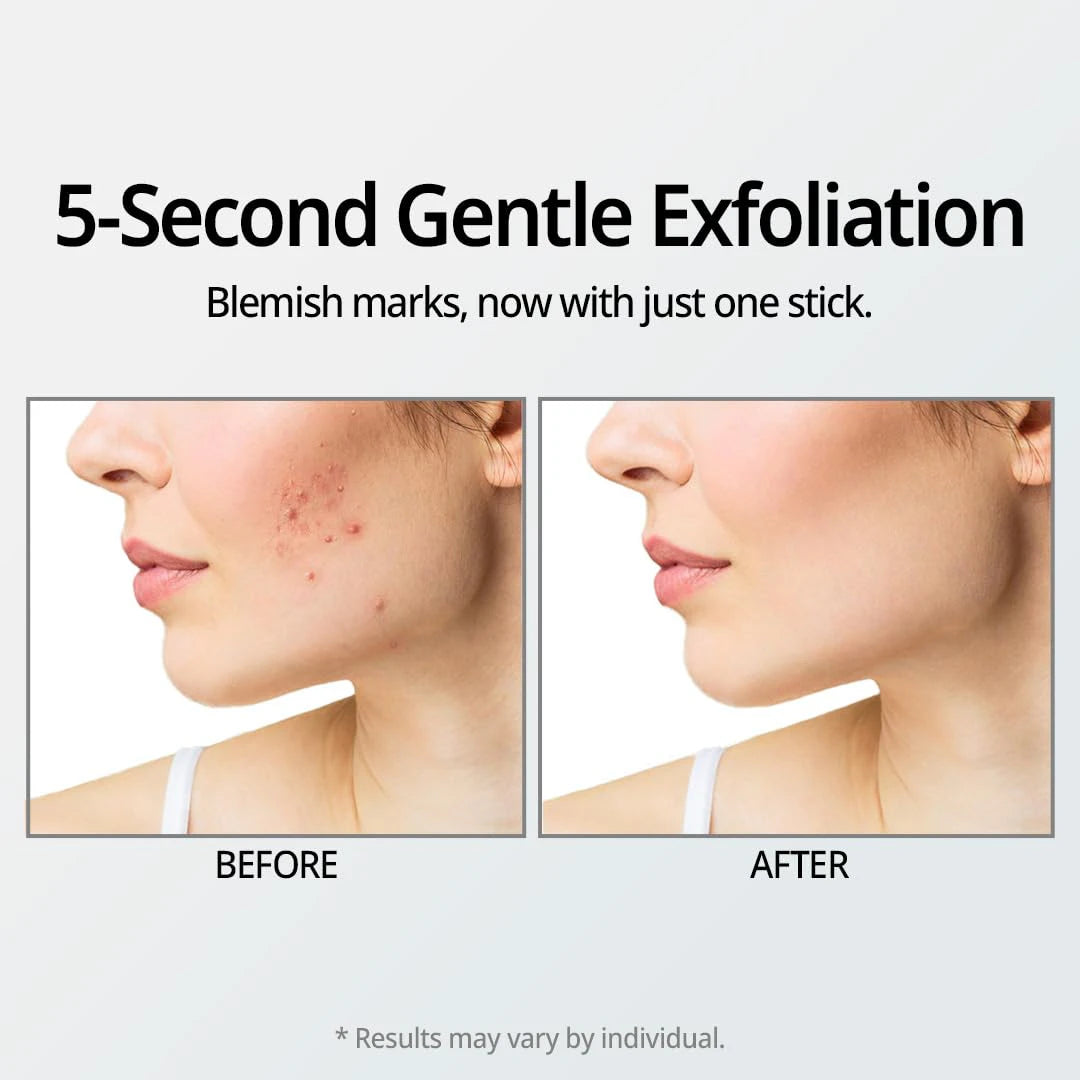Dr. Oracle 21;Stay A-Thera Peeling Stick (10 Sticks) Korean Exfoliators