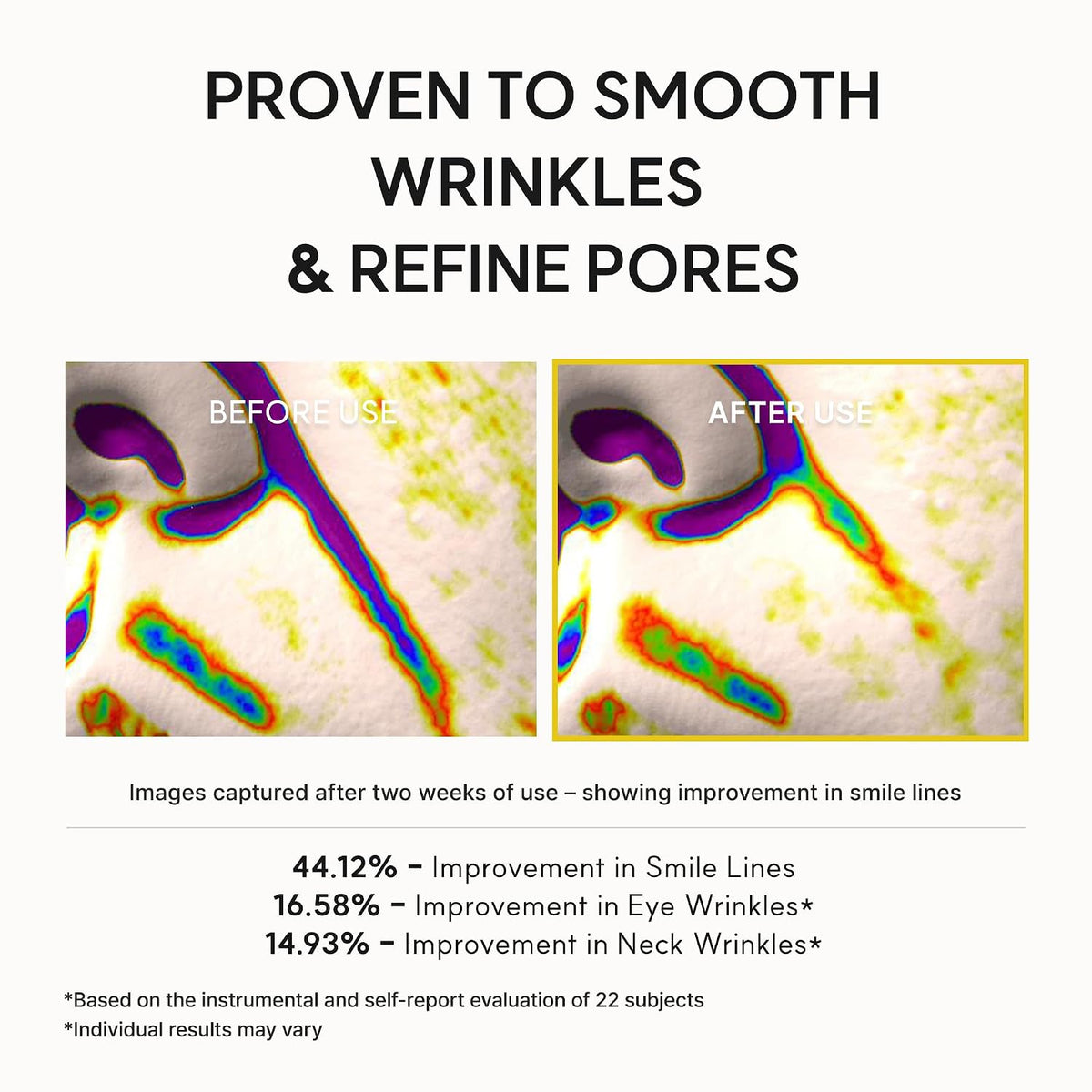 Arencia study graphic reporting smile-line, eye-wrinkle and neck-wrinkle improvements in 22 subjects; individual results may vary