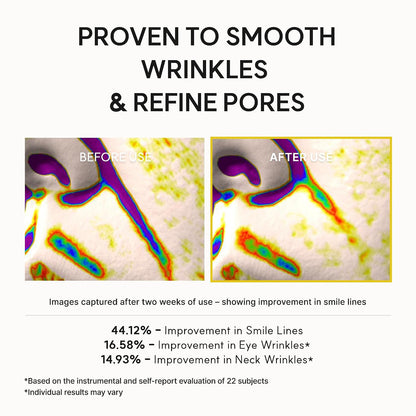 Arencia study graphic reporting smile-line, eye-wrinkle and neck-wrinkle improvements in 22 subjects; individual results may vary