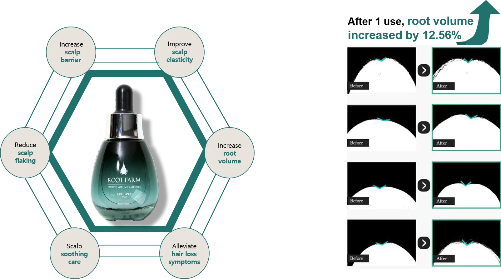 roobliss Rootfarm Scalp Root Care Ampoule Korean Hair Care