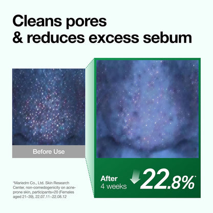 Pore before and after panel for ANUA Heartleaf Pore Control Cleansing Oil showing 22.8% reduced sebum after 4 weeks.