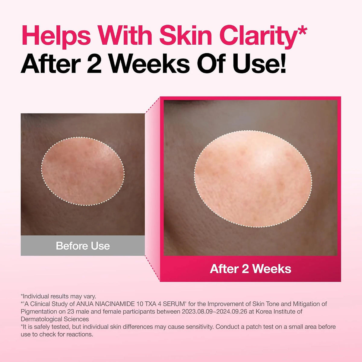 ANUA Niacinamide 10% + TXA 4% Serum study graphic comparing skin before use and after two weeks; individual results may vary.