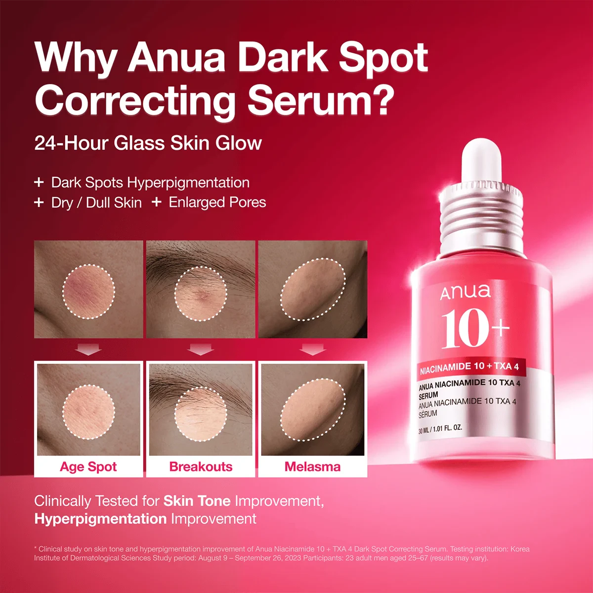ANUA Niacinamide 10% + TXA 4% Serum dark spot care graphic with examples of uneven pigmentation and post-blemish marks.