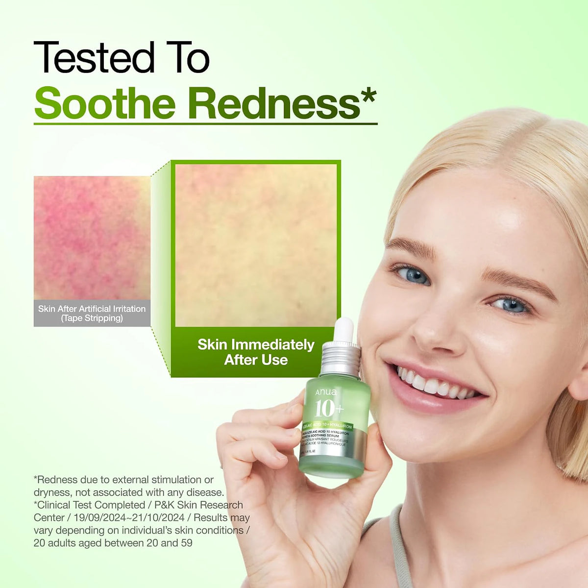 ANUA Azelaic Acid 10 Hyaluron Redness Soothing Serum redness soothing comparison with model