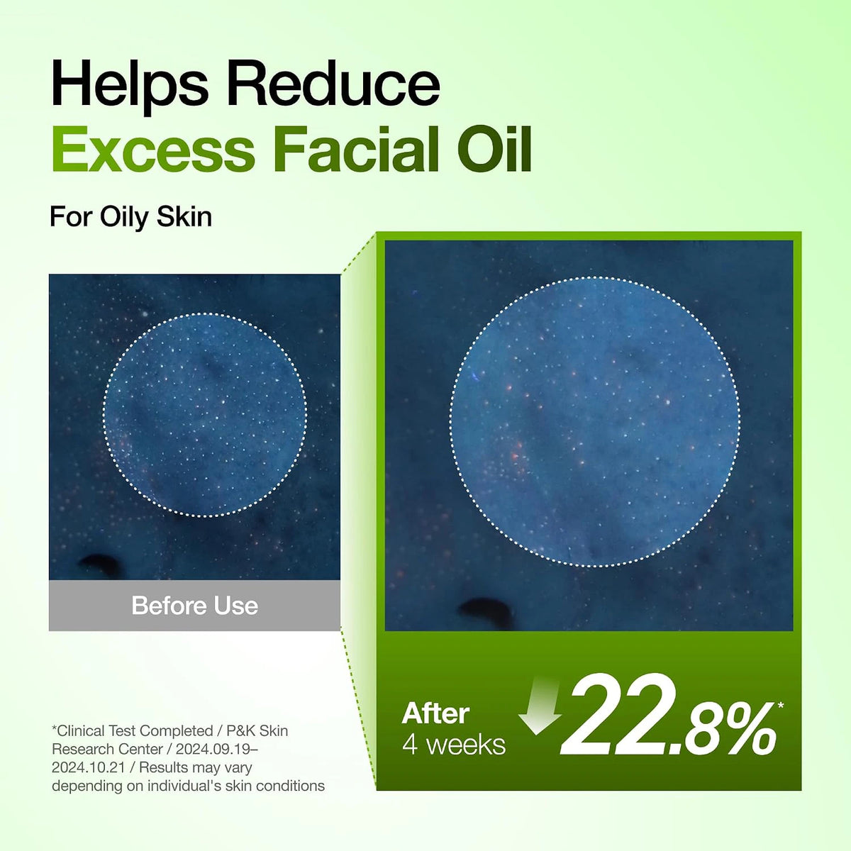 ANUA Azelaic Acid 10 Hyaluron Redness Soothing Serum how to use graphic with dropper