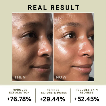 BRMUD Relief Mud Mask 110ml