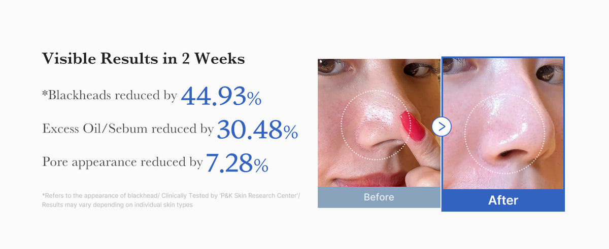 medicube Zero Pore Pad 2.0 before-and-after comparison graphic with pore care results