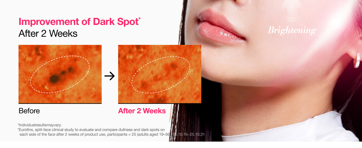 ANUA toner study panel with before-and-after close-ups showing reported improvement in a dark spot after two weeks.