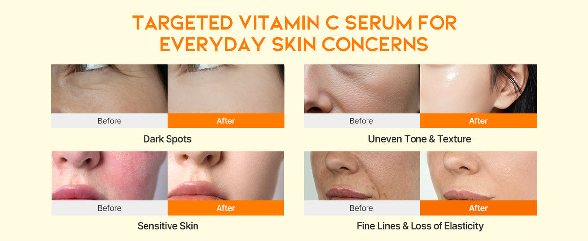 #OOTD Dark Spot Vitamin C Serum 50ml product information panel 04