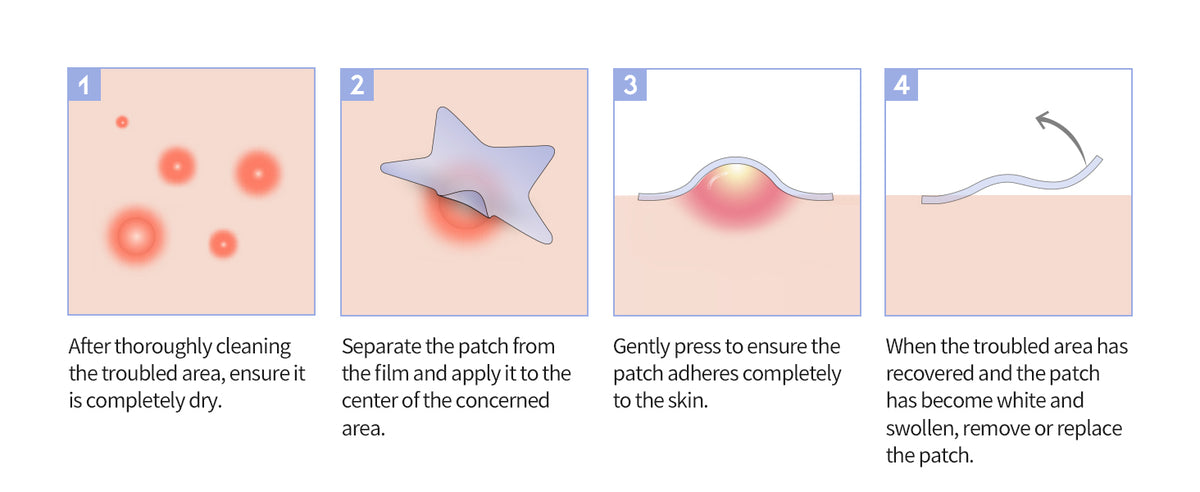 #OOTD Star Spot Pimple Patch, 80 Dots product information panel 07