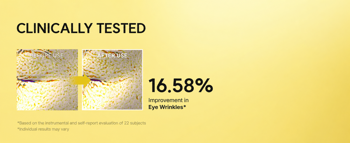 Arencia study graphic reporting 16.58% improvement in eye wrinkles in 22 subjects, with before-and-after images; individual results may vary