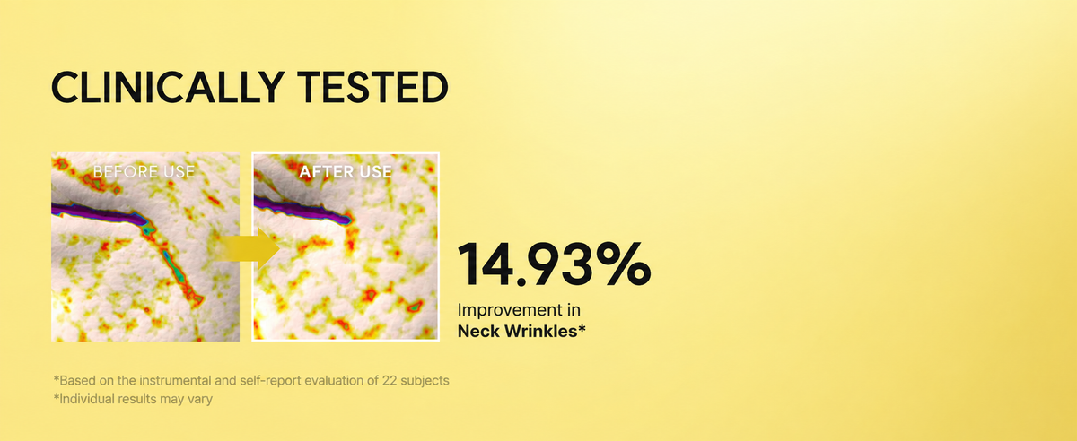 Arencia study graphic reporting 14.93% improvement in neck wrinkles in 22 subjects, with before-and-after images; individual results may vary