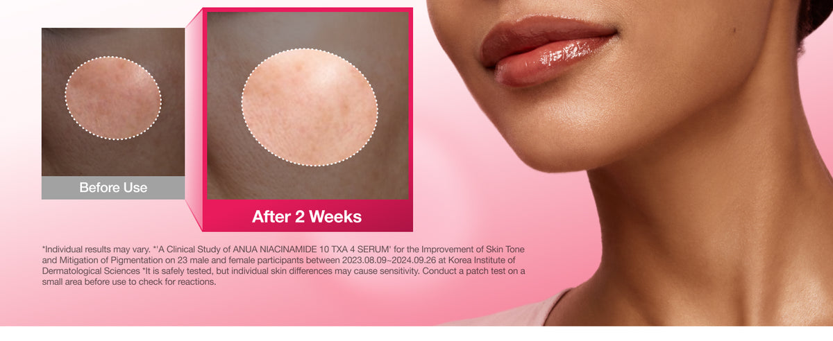 ANUA Niacinamide 10% + TXA 4% Serum study photos comparing skin before use and after two weeks; individual results may vary.