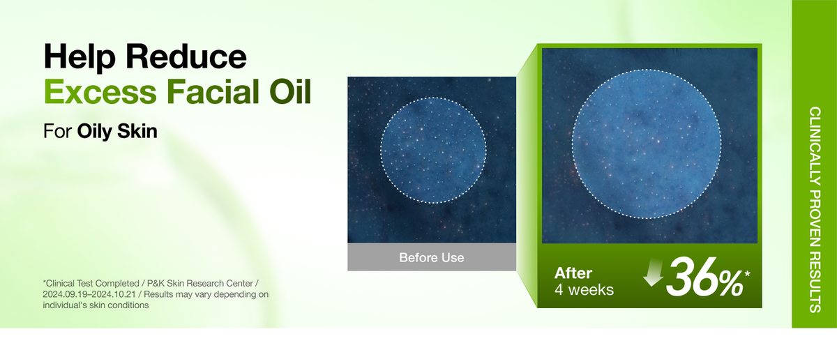 ANUA Azelaic Acid 10 Hyaluron Redness Soothing Serum excess facial oil before and after comparison