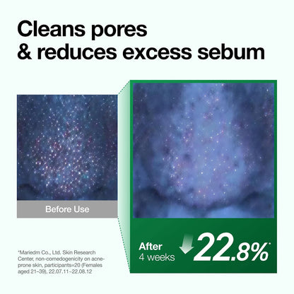 Pore and sebum before-and-after infographic with a four-week reduction claim for ANUA cleansing care.